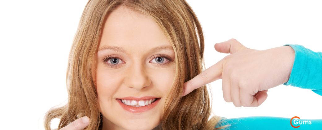 5 מיתוסים שגויים על יישור שיניים שאתם חייבים להכיר - בחורה ג'ינג'ית מדגימה חיוך יפה ומצביעה על החיוך שלה ובצד ימין למטה לוגו אתר GUMS